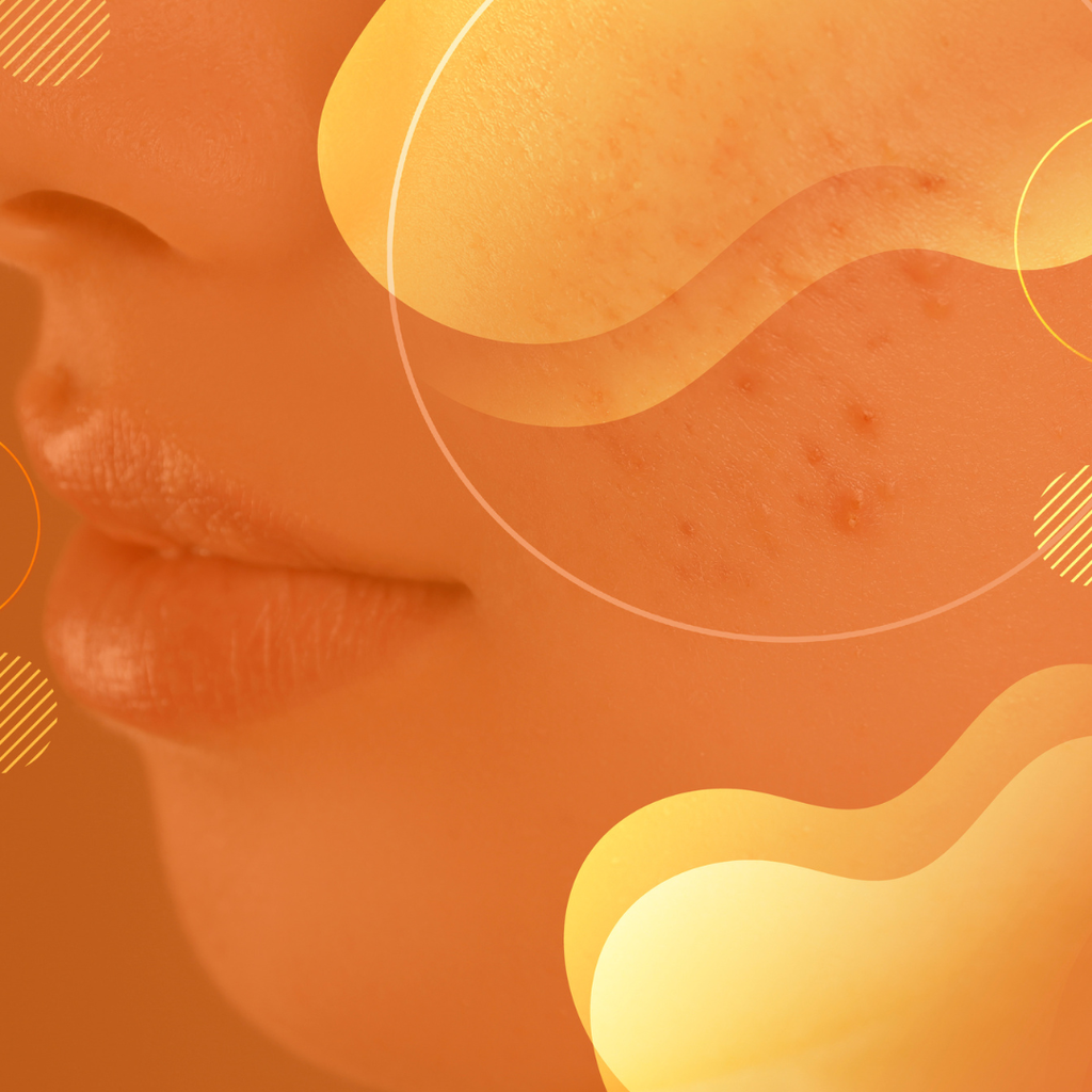 Curso de psoriasis para médicos generales